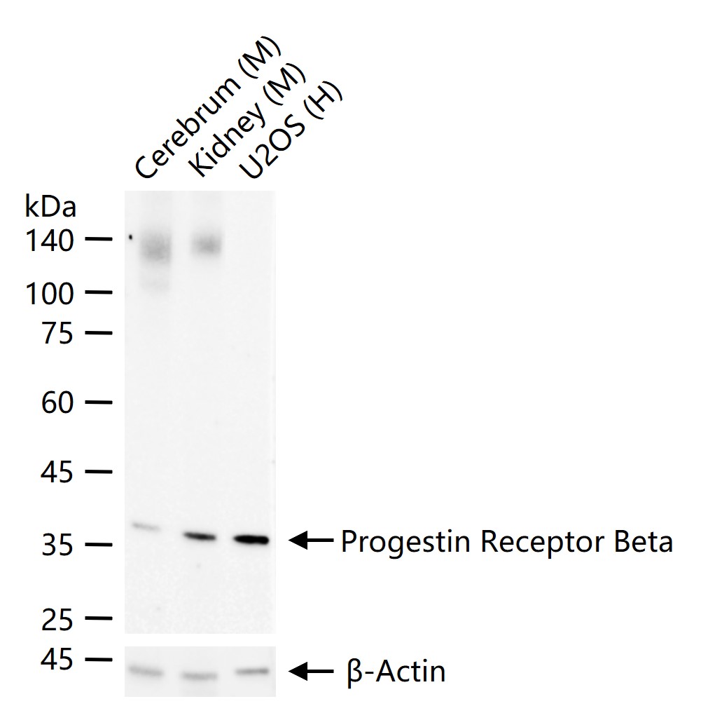 Progestin Receptor Beta Rabbit