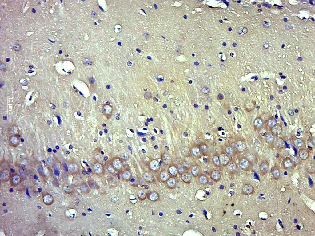 phospho-TrkB (Tyr705) Rabbit p