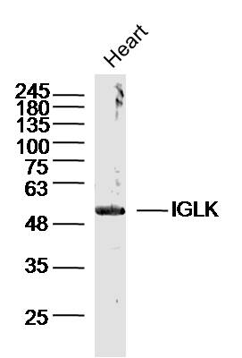 IGLK Rabbit pAb(bs-15576R)-50u
