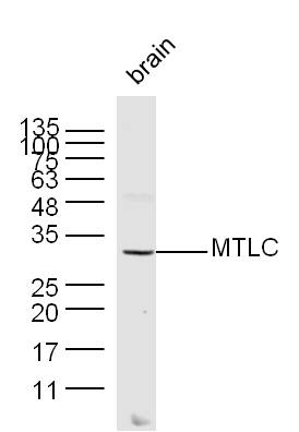 MTLC Rabbit pAb(bs-0334R)-50ul