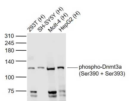 phospho-Dnmt3a (Ser390 + Ser39