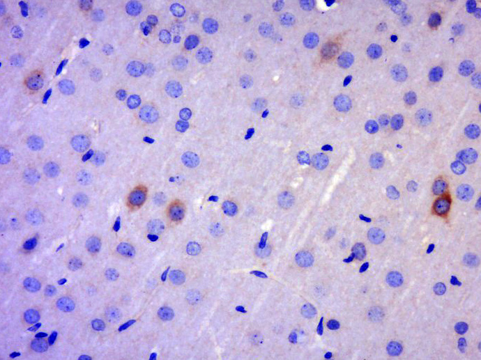 GK2 Rabbit pAb(bs-13366R)-50ul