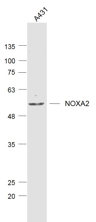 NOXA2 Rabbit pAb(bs-21423R)-50