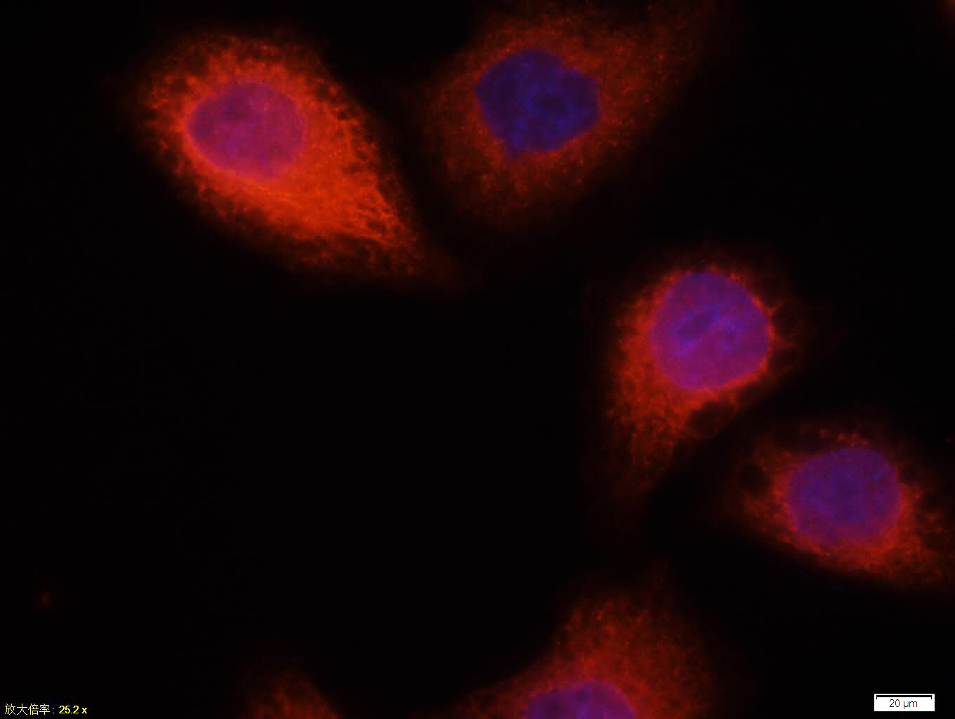 CK18 Mouse mAb(bsm-33102M)-50u