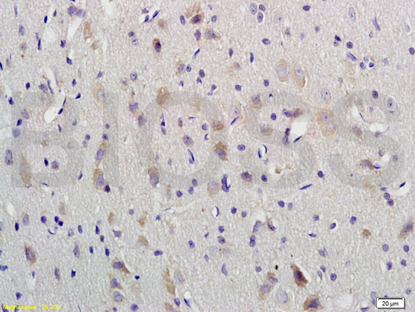 VIP Rabbit pAb(bs-0077R)-50ul/