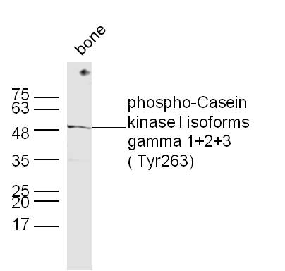 phospho-CSNK1G 1+2+3 ( Tyr263)
