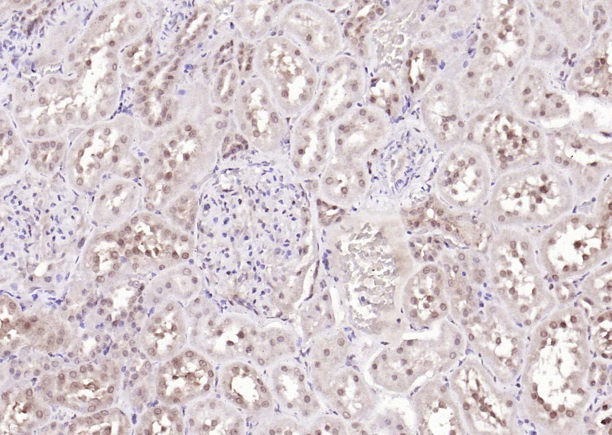 ANKRD54 Rabbit pAb(bs-20549R)-