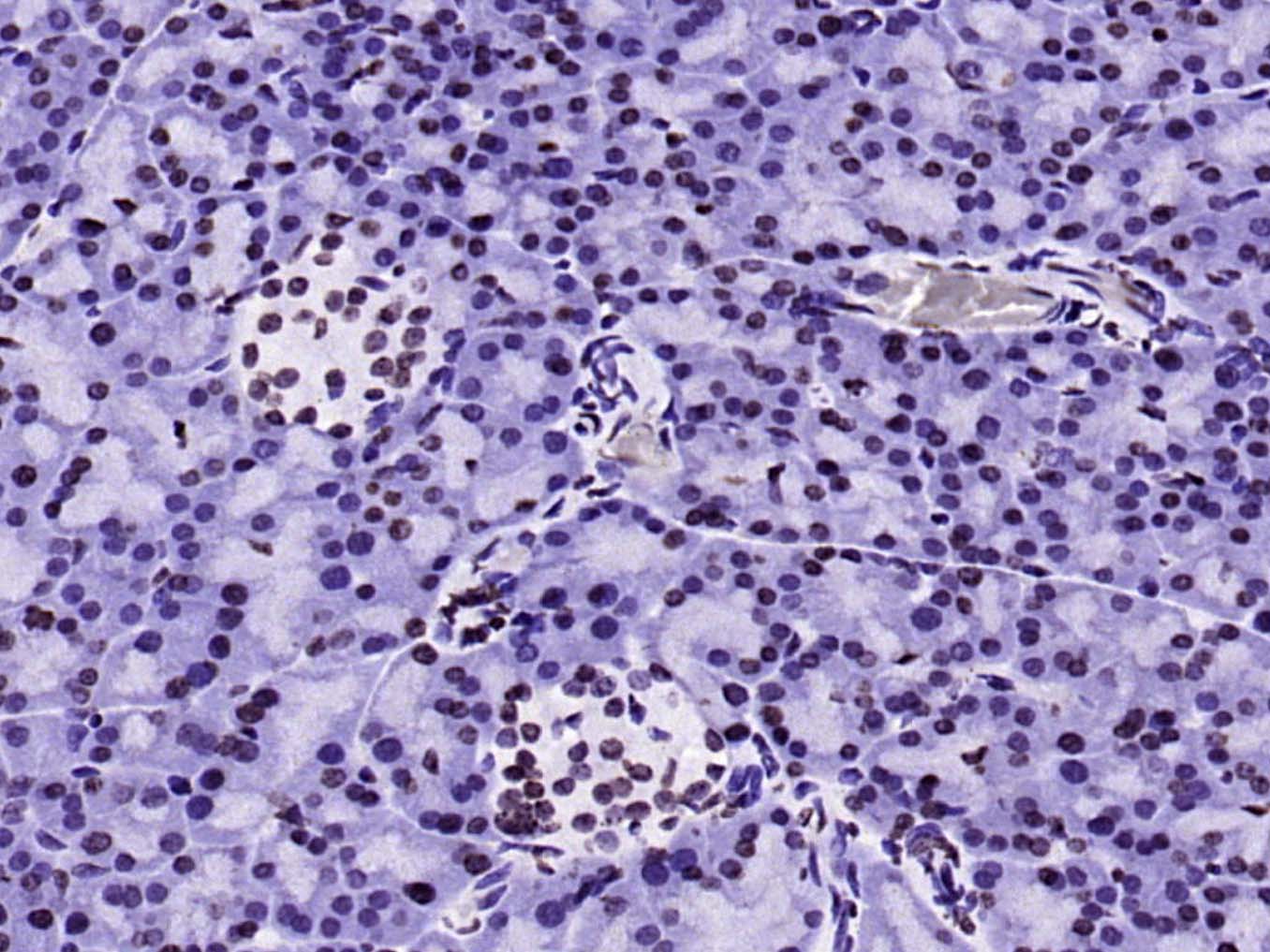 Histone H3 (mono methyl K9) Mo