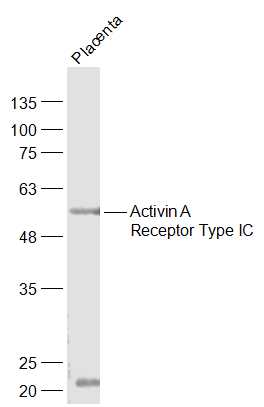 Activin A Receptor Type IC Rab