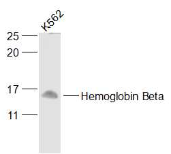 Hemoglobin Beta Rabbit pAb(bs-