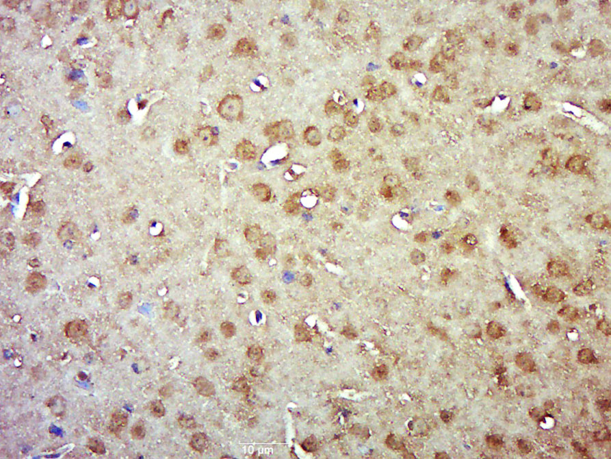 SMG1 Rabbit pAb(bs-12637R)-50u