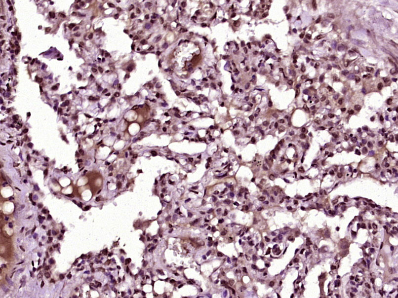 Kindlin 2 Rabbit pAb(bs-12371R