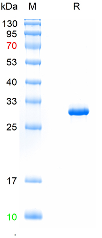Recombinant PRRSV-GP5 protein,