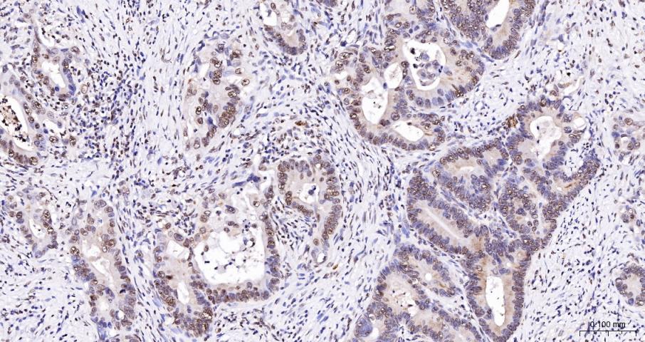 Histone H3(di methyl K27) Mous