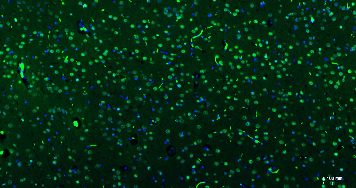 Histone H3(di methyl K27) Mous