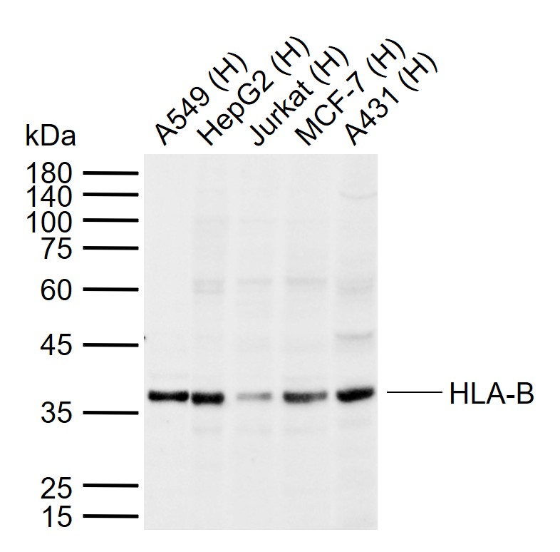 HLA-B Rabbit pAb(bs-8604R)-50u