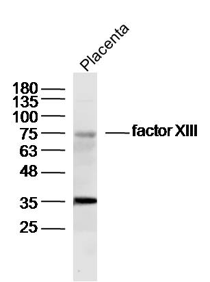 factor XIII Rabbit pAb(bs-1587