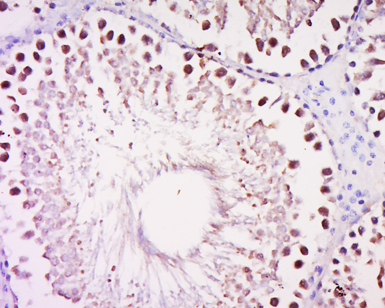 DALRD3 Rabbit pAb(bs-14192R)-5