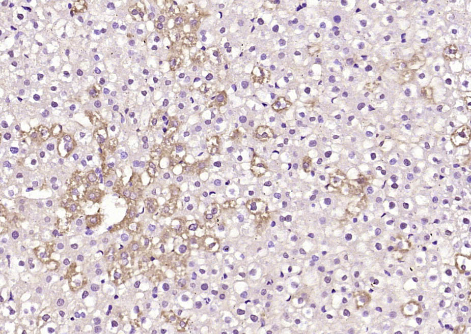 DIAPH3 Rabbit pAb(bs-14325R)-5