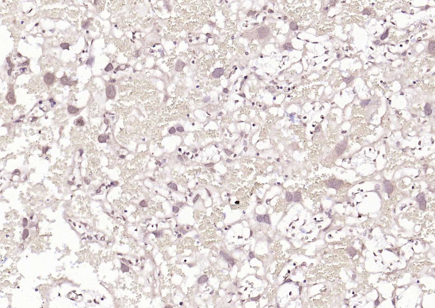 HSF1 Rabbit pAb(bs-3757R)-50ul