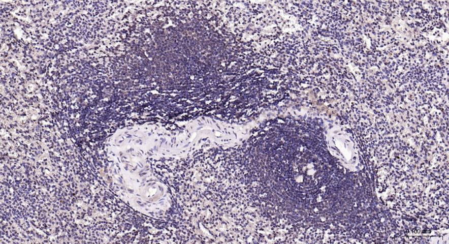 PI3 Kinase p110 beta Rabbit pA