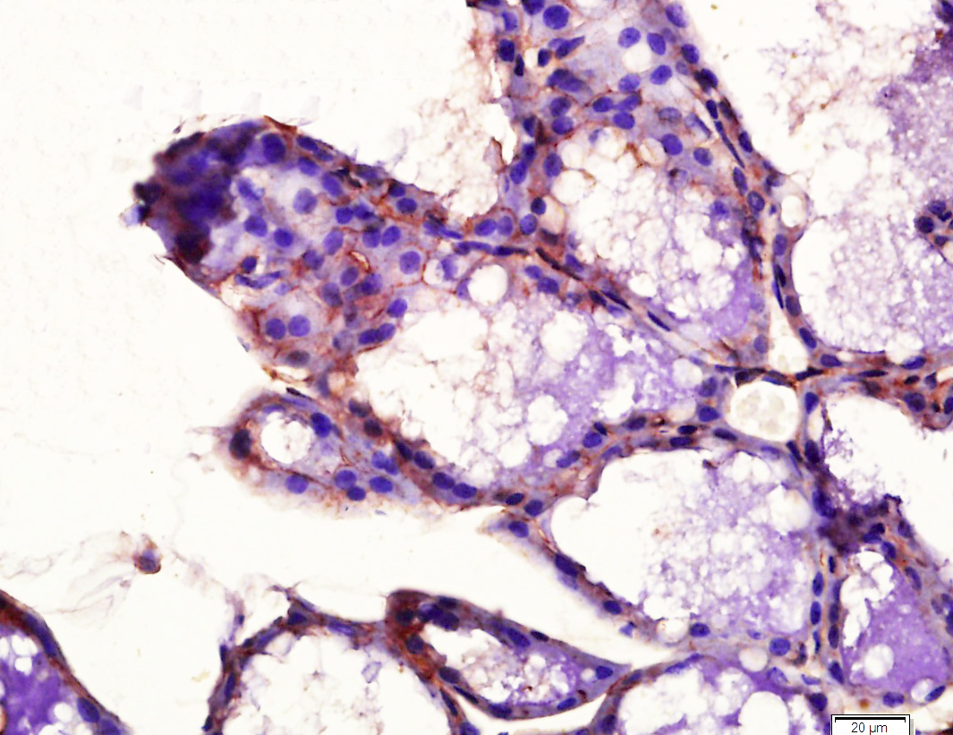 phospho-PDGFRA (Tyr754) Rabbit