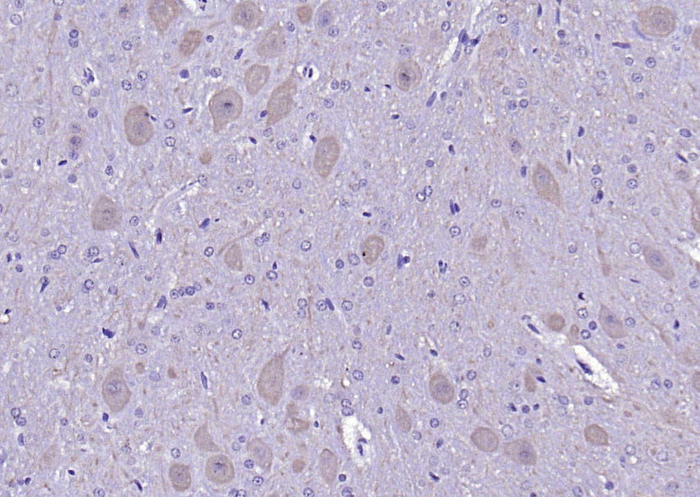 Calmodulin 1/2/3 Rabbit pAb(bs