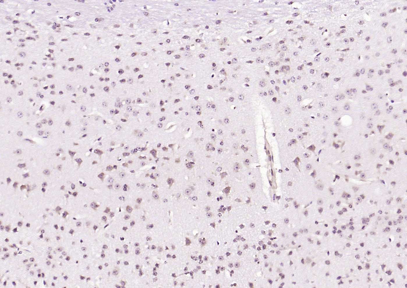 PLK1 Rabbit pAb(bs-3535R)-50ul