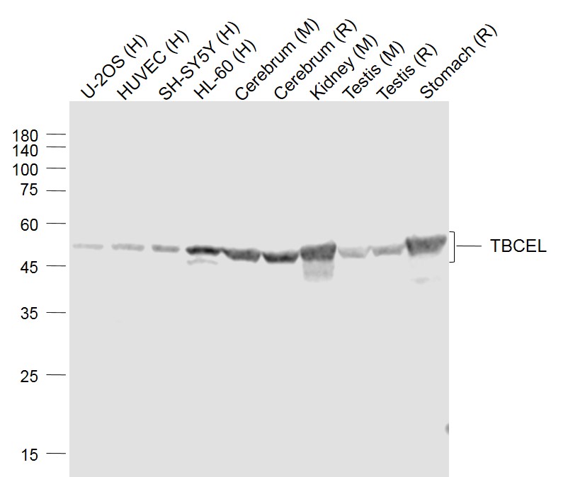 TBCEL Rabbit pAb(bs-10292R)-50