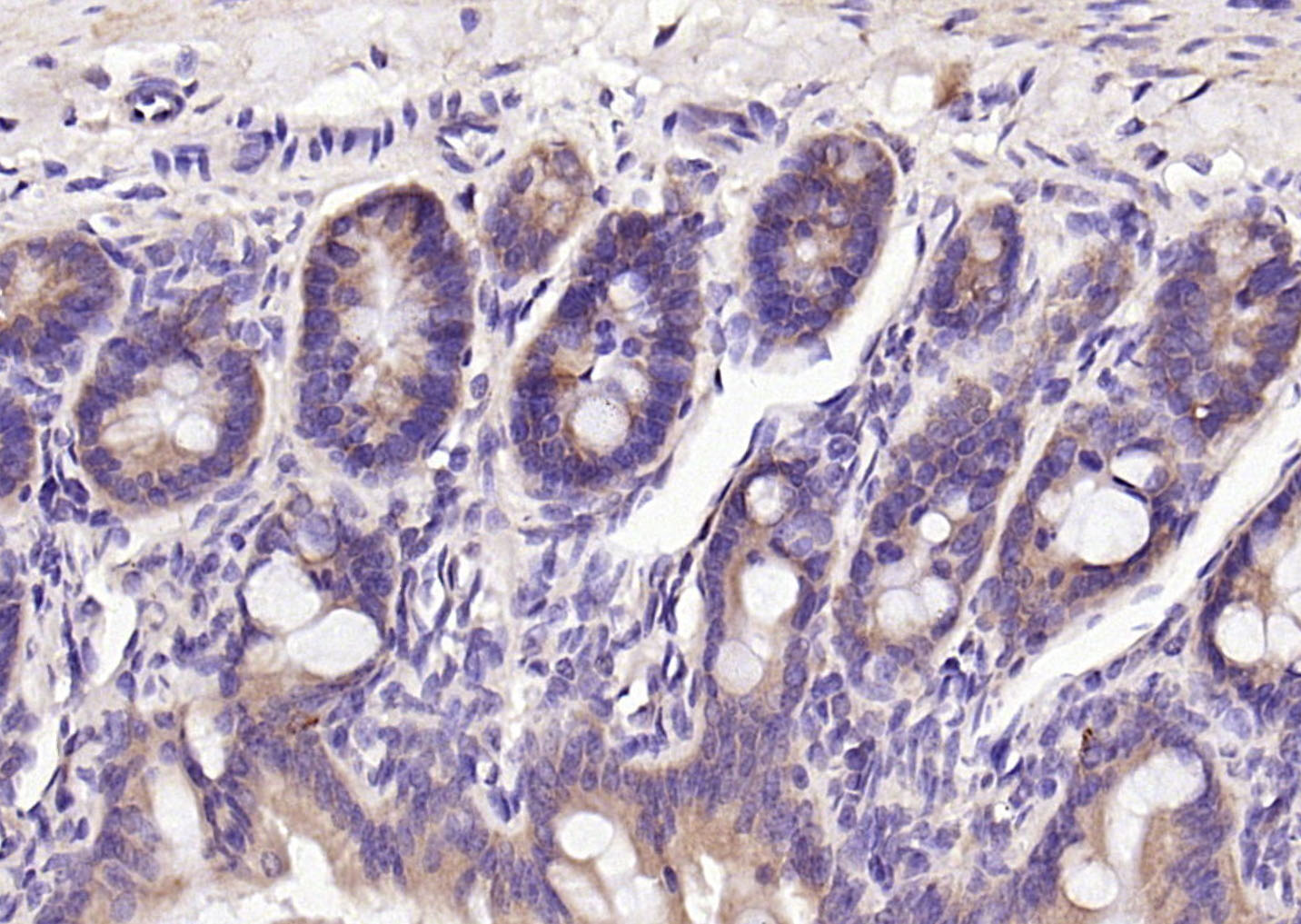 Ceramide glucosyltransferase R
