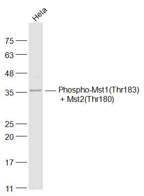 phospho-Mst1(Thr183) + Mst2(Th