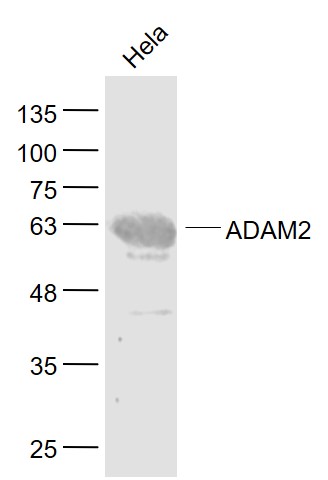 ADAM2 Rabbit pAb(bs-20815R)-50