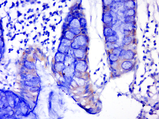 GK2 Rabbit pAb(bs-13366R)-50ul
