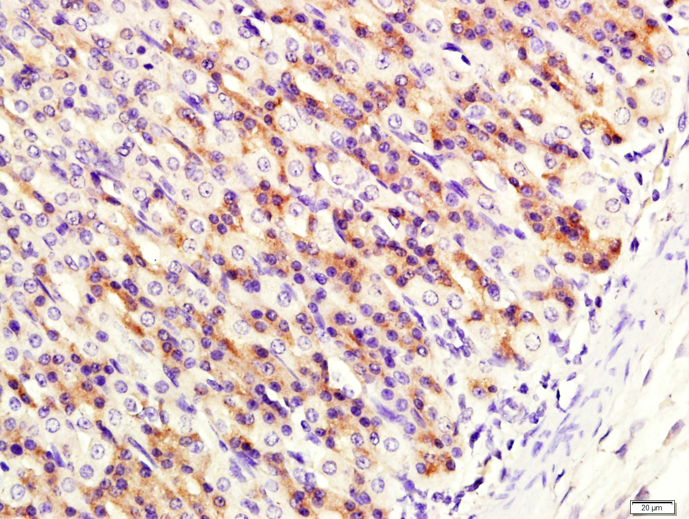 UGT1A7 Rabbit pAb(bs-20068R)-5