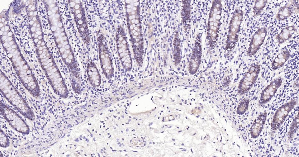 PCNA Rabbit pAb(bs-10889R)-50u