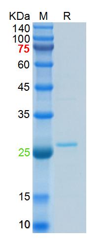 Recombinant SARS-Cov-2 N prote
