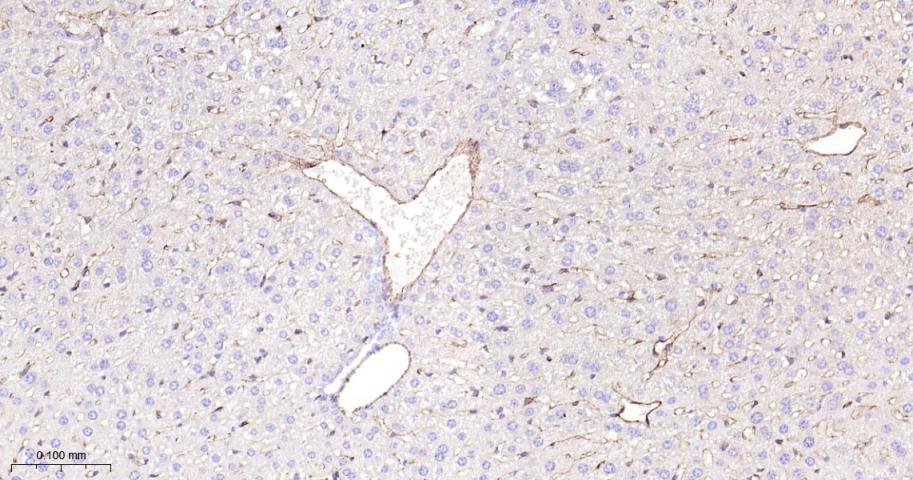 CD31 Rabbit pAb(bs-20322R)-50u