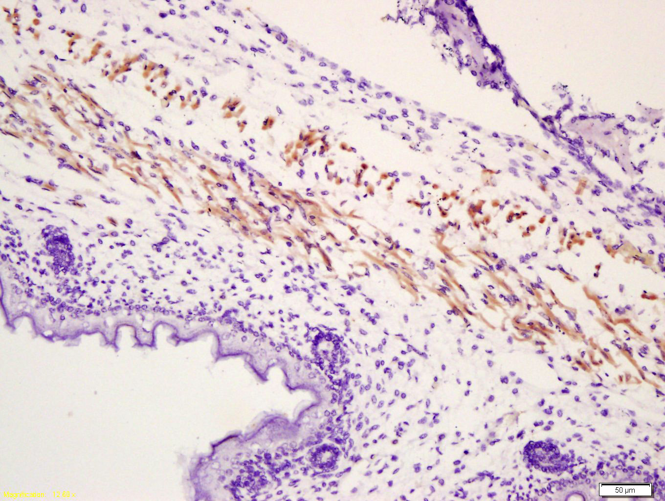 phospho-MYL (Ser19) Rabbit pAb