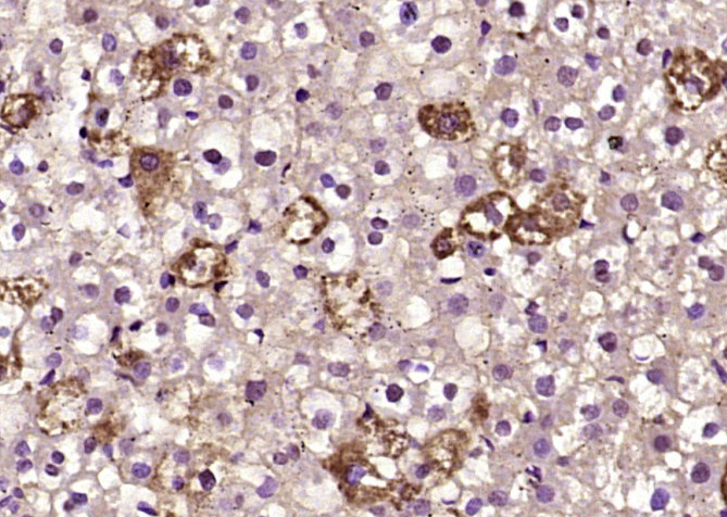 BLMH Rabbit pAb(bs-11654R)-50u