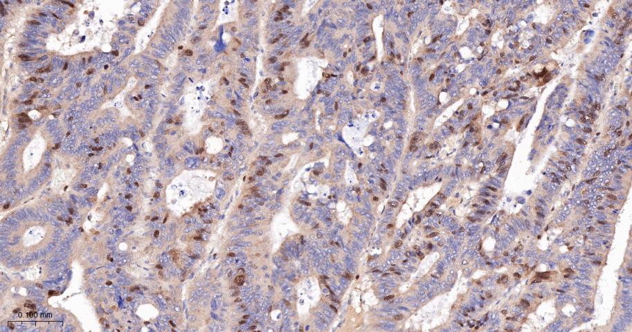 CCNA2 Recombinant Rabbit mAb(b