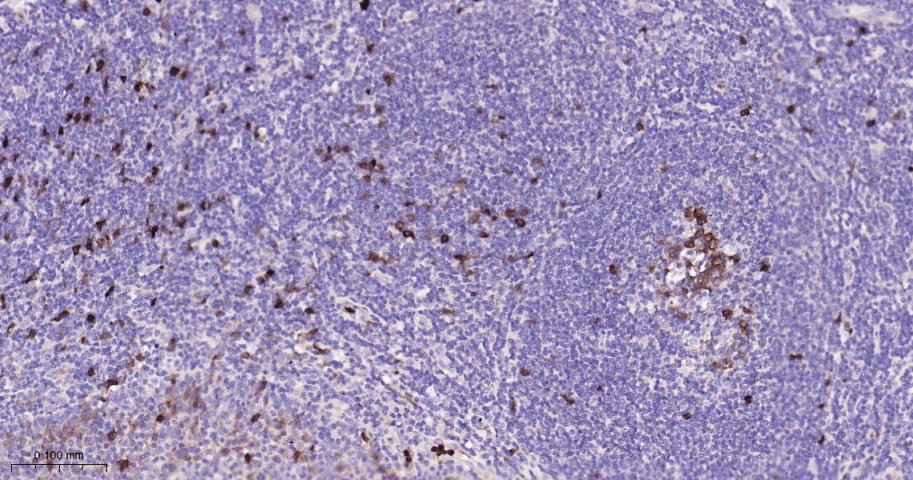 TYMS Recombinant Rabbit mAb(bs