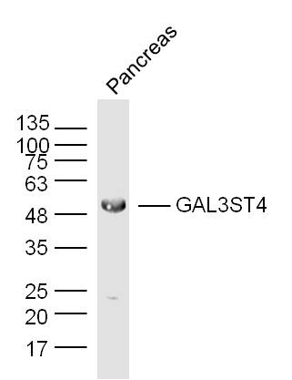 GAL3ST4 Rabbit pAb(bs-16215R)-