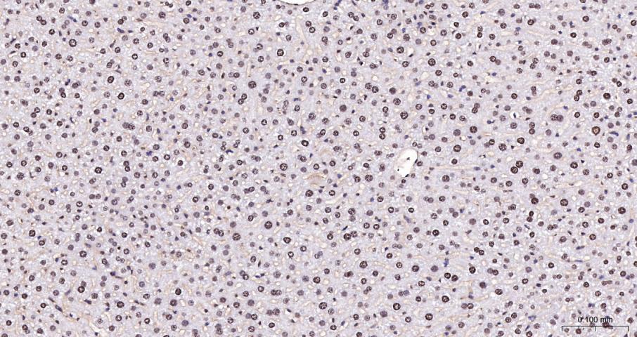 Histone H3(di methyl K27) Mous