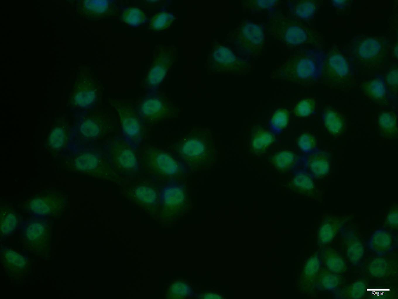 phospho-KLF5 (Ser311) Rabbit p