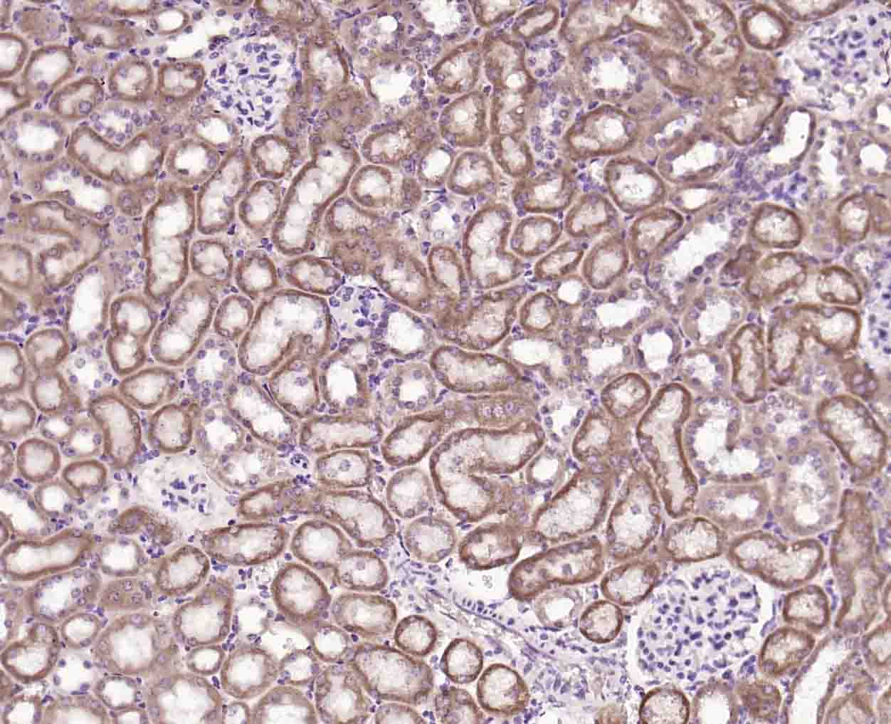 phospho-PLB (Ser16) Rabbit pAb