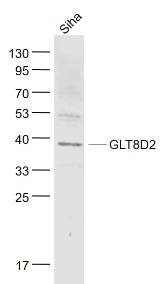 GLT8D2 Rabbit pAb(bs-8302R)-50