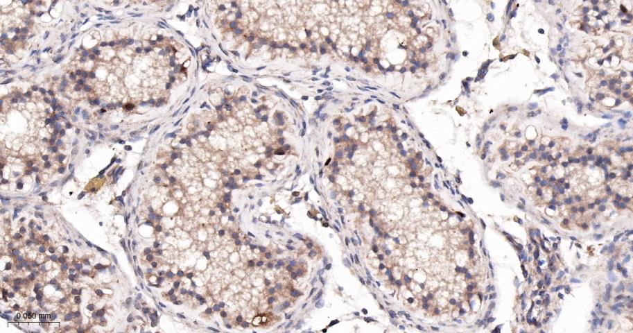 CCNA2 Recombinant Rabbit mAb(b