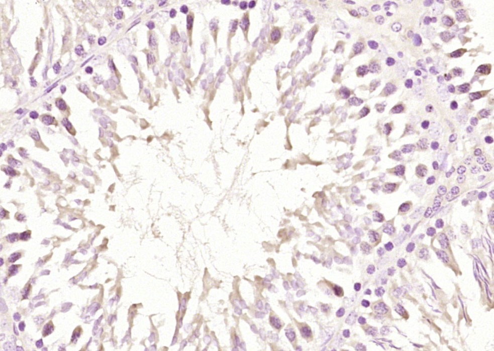 ABH8 Rabbit pAb(bs-6510R)-50ul