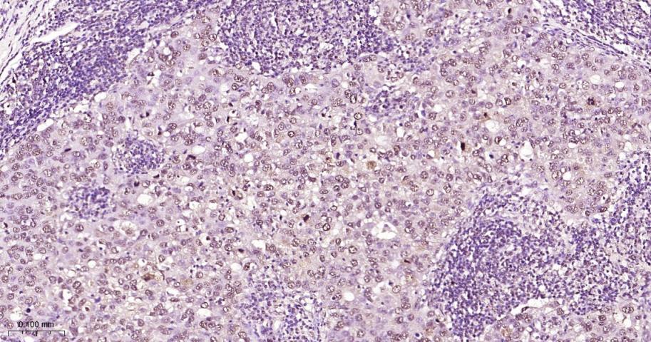 phospho-STAT3 (Tyr705) Mouse m