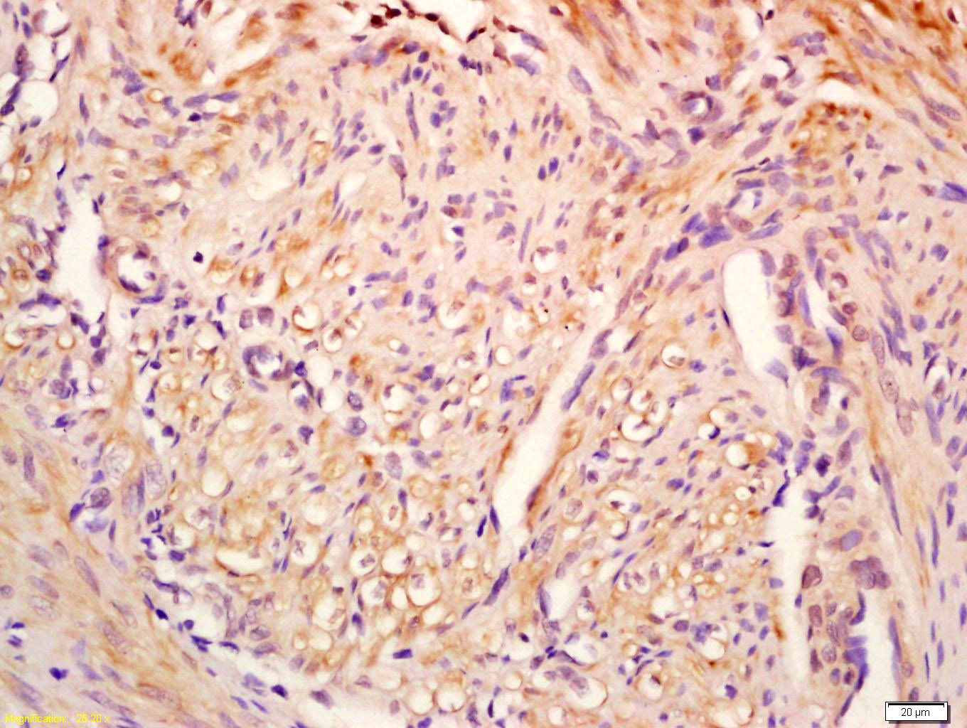 GCDFP15 Rabbit pAb(bs-10273R)-